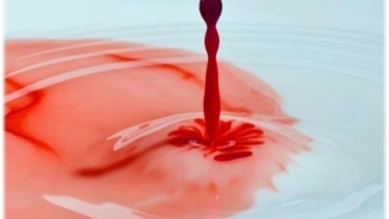 secreción sanguenta do pene